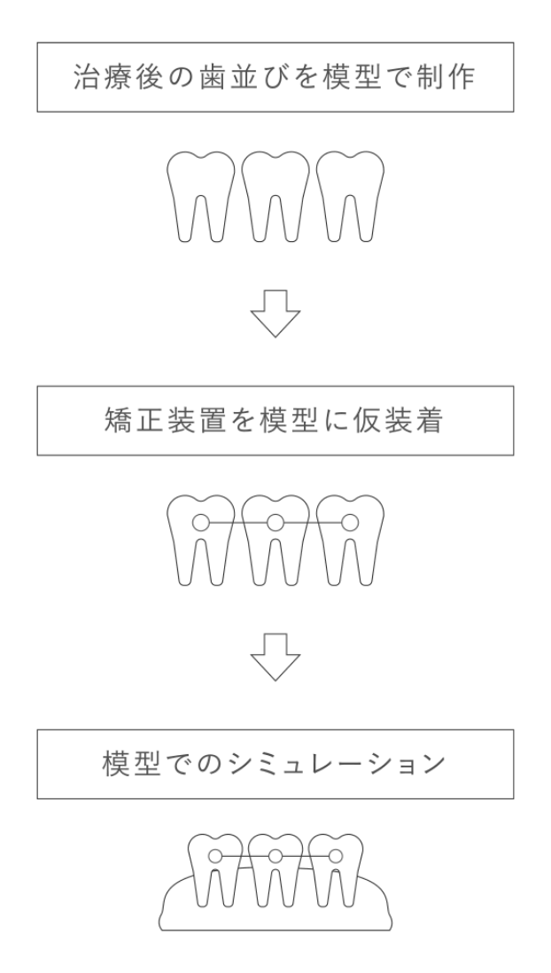 治療後の歯並びを模型で制作 矯正装置を模型に仮装着 模型でのシミュレーション