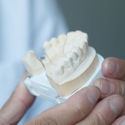 治療後の歯並びのイメージ模型を作製
